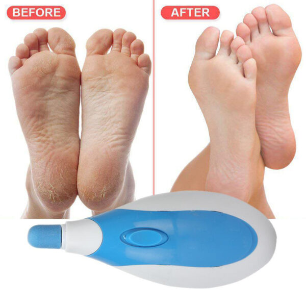 ⁦Precise Pedi قلم باديكير للقدم⁩ - الصورة ⁦2⁩